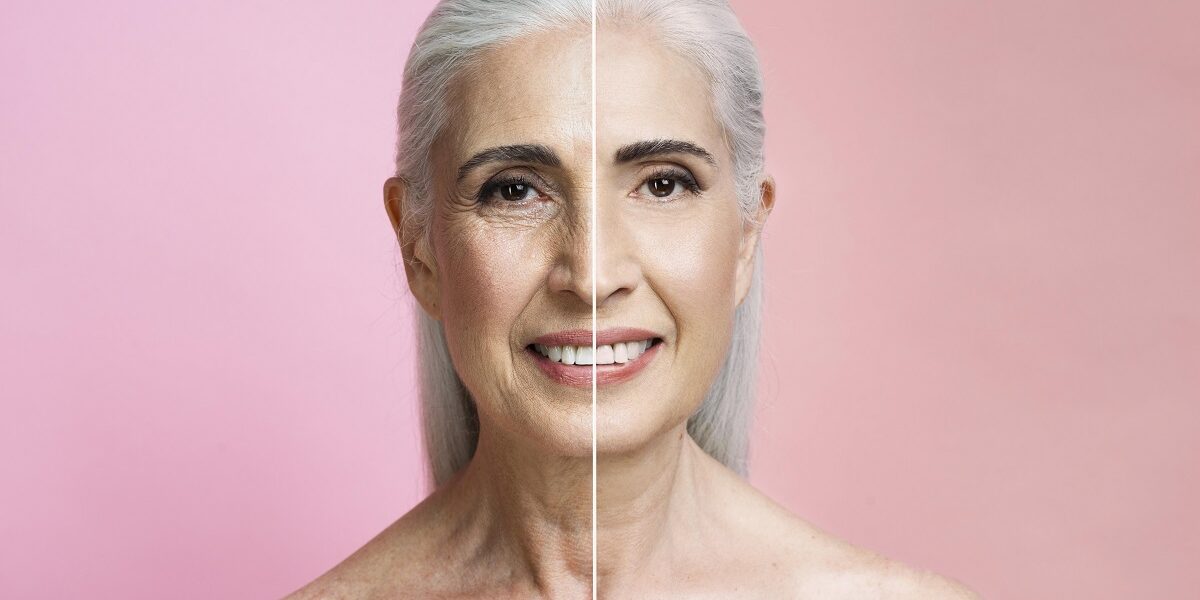 Non-Surgical Facelift