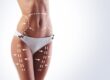 How Long to See Results From Liposuction